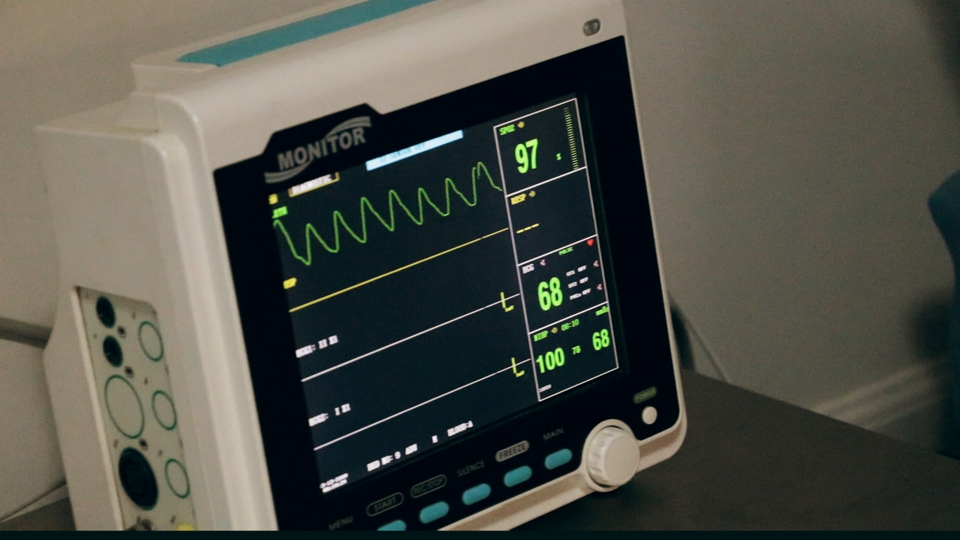 EKG (Elektrokardiyografi)